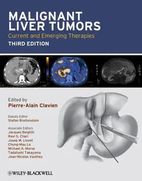 Clavien |  Malignant Liver Tumors | Buch |  Sack Fachmedien