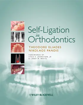 Eliades / Pandis |  Self-Ligation in Orthodontics | Buch |  Sack Fachmedien