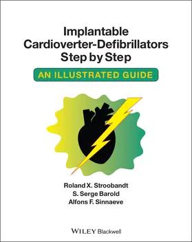 Stroobandt / Barold / Sinnaeve | Implantable Cardioverter - Defibrillators Step by Step | Buch | 978-1-4051-8638-4 | sack.de