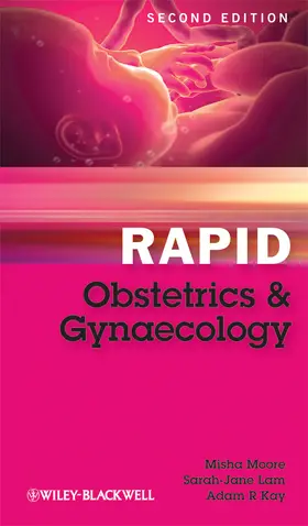 Moore / Lam / Kay | Rapid Obstetrics Gynaecology 2e | Buch | 978-1-4051-9450-1 | www.sack.de