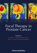 Ahmed / Arya / Carroll |  Focal Therapy in Prostate Cancer | Buch |  Sack Fachmedien