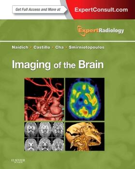 Naidich / Castillo / Cha | Imaging of the Brain | Buch | 978-1-4160-5009-4 | sack.de