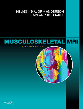Helms / Major / Anderson | Musculoskeletal MRI | Buch | 978-1-4160-5534-1 | sack.de