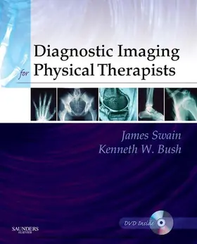 Swain MPT / Swain / Brosing |  Diagnostic Imaging for Physical Therapists | eBook | Sack Fachmedien