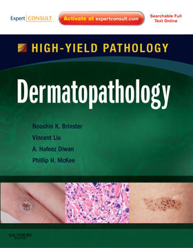 Brinster / Liu / Diwan |  Dermatopathology: A Volume in the High Yield Pathology Series (Expert Consult - Online and Print) [With Access Code] | Buch |  Sack Fachmedien
