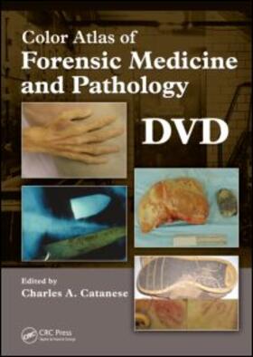 Catanese | Color Atlas of Forensic Medicine and Pathology, DVD | Sonstiges | 978-1-4200-4322-8 | sack.de