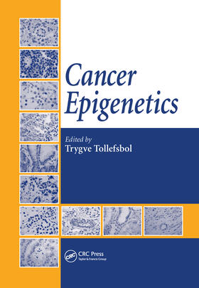 Tollefsbol | Cancer Epigenetics | Buch | 978-1-4200-4579-6 | sack.de