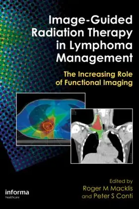 Macklis / Conti |  Image-Guided Radiation Therapy in Lymphoma Management | Buch |  Sack Fachmedien