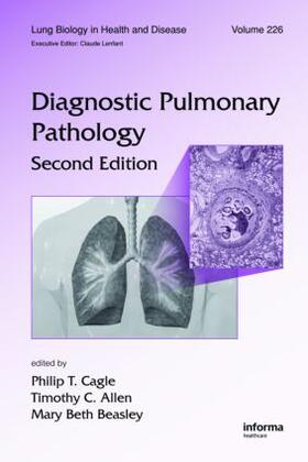 Cagle / Allen / Beasley |  Diagnostic Pulmonary Pathology | Buch |  Sack Fachmedien