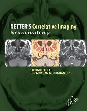 Lee / Mukundan | Netter's Correlative Imaging: Neuroanatomy with Access Code | Buch | 978-1-4377-0415-0 | sack.de