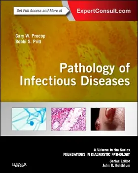 Procop / Pritt |  Pathology of Infectious Diseases: A Volume in the Series: Foundations in Diagnostic Pathology | Buch |  Sack Fachmedien