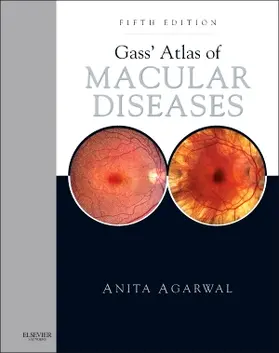Agarwal | Gass' Atlas of Macular Diseases | Buch | 978-1-4377-1580-4 | sack.de