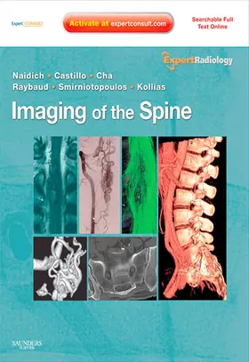 Naidich MD / Castillo MD / Castillo |  Imaging of the Spine E-Book | eBook | Sack Fachmedien