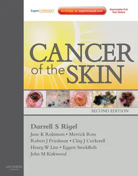 Rigel / Friedman / Robinson |  Cancer of the Skin E-Book | eBook | Sack Fachmedien