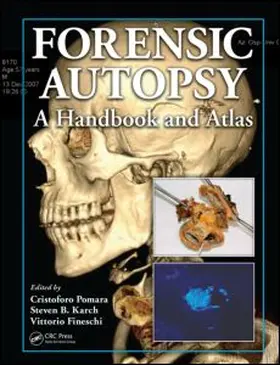 Pomara / Fineschi / Karch | Forensic Autopsy | Buch | 978-1-4398-0064-5 | www.sack.de