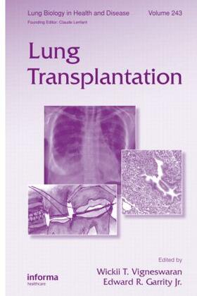 Vigneswaran / Garrity Jr. |  Lung Transplantation | Buch |  Sack Fachmedien