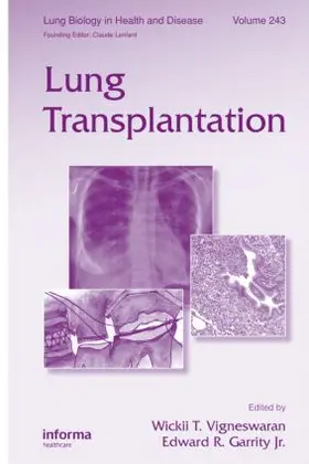 Vigneswaran / Garrity Jr. |  Lung Transplantation | Buch |  Sack Fachmedien