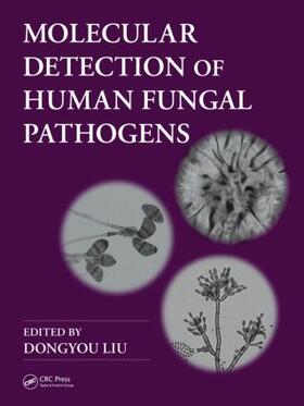 Liu | Molecular Detection of Human Fungal Pathogens | Buch | 978-1-4398-1240-2 | sack.de