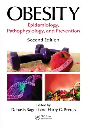 Bagchi / Preuss | Obesity | Buch | 978-1-4398-5425-9 | www.sack.de