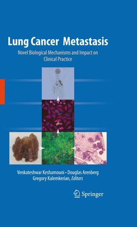 Keshamouni / Kalemkerian / Arenberg | Lung Cancer Metastasis | Buch | 978-1-4419-0771-4 | sack.de