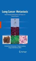 Keshamouni / Arenberg / Kalemkerian |  Lung Cancer Metastasis | eBook | Sack Fachmedien