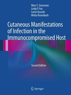 Grossman / Fox / Kovarik |  Cutaneous Manifestations of Infection in the Immunocompromised Host | eBook | Sack Fachmedien