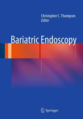 Thompson |  Bariatric Endoscopy | eBook | Sack Fachmedien