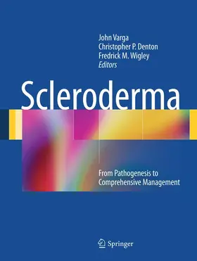 Varga |  Scleroderma | eBook | Sack Fachmedien