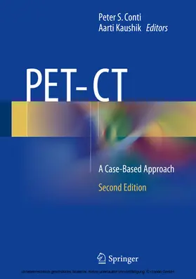 Conti / Kaushik |  PET-CT | eBook | Sack Fachmedien