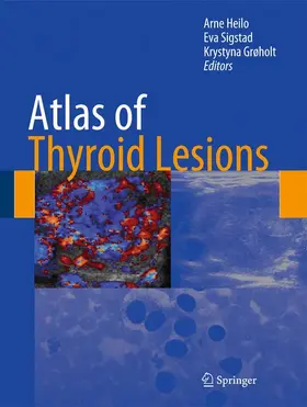 Heilo / Grøholt / Sigstad |  Atlas of Thyroid Lesions | Buch |  Sack Fachmedien