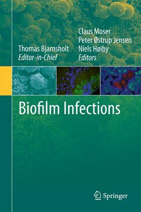Bjarnsholt / Høiby / Jensen | Biofilm Infections | Buch | 978-1-4419-6083-2 | sack.de