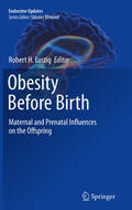 Lustig |  Obesity Before Birth | eBook | Sack Fachmedien