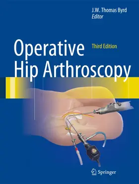 Byrd | Operative Hip Arthroscopy | Buch | 978-1-4419-7924-7 | www.sack.de