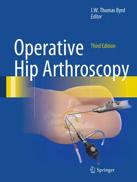 Byrd | Operative Hip Arthroscopy | E-Book | www.sack.de