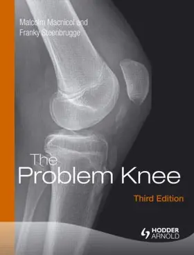 Macnicol / Steenbrugge |  The Problem Knee | Buch |  Sack Fachmedien