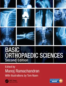 Ramachandran |  Basic Orthopaedic Sciences | Buch |  Sack Fachmedien