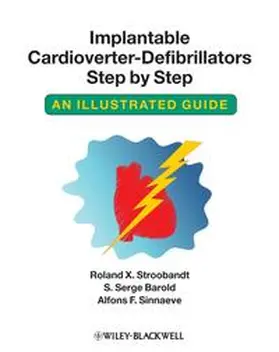 Stroobandt / Barold / Sinnaeve | Implantable Cardioverter - Defibrillators Step by Step | E-Book | sack.de