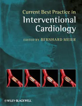 Meier |  Current Best Practice in Interventional Cardiology | eBook | Sack Fachmedien