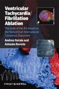 Natale / Raviele |  Ventricular Tachycardia / Fibrillation Ablation | eBook | Sack Fachmedien