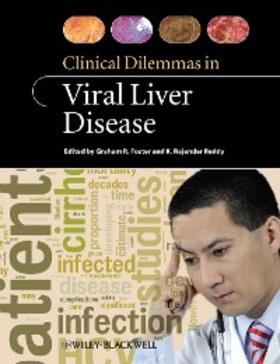 Foster / Reddy | Clinical Dilemmas in Viral Liver Disease | E-Book | sack.de