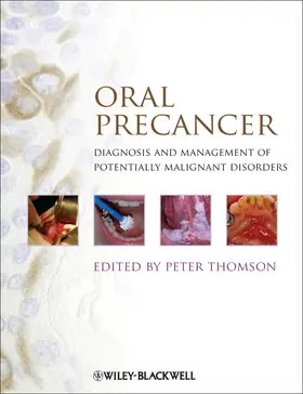 Thomson |  Oral Precancer | Buch |  Sack Fachmedien