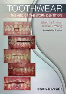 Khan / Young |  Toothwear | eBook | Sack Fachmedien