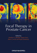 Ahmed / Arya / Carroll |  Focal Therapy in Prostate Cancer | eBook | Sack Fachmedien
