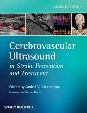 Alexandrov |  Cerebrovascular Ultrasound in Stroke Prevention and Treatment | eBook | Sack Fachmedien