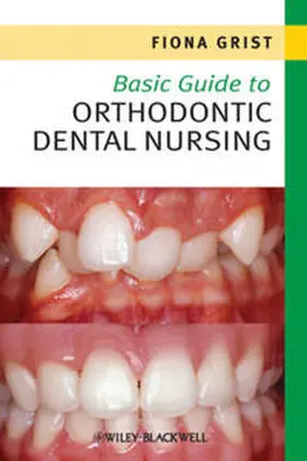Grist |  Basic Guide to Orthodontic Dental Nursing | eBook | Sack Fachmedien