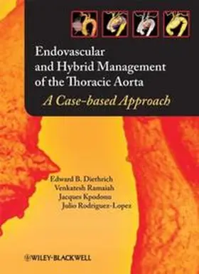 Diethrich / Ramaiah / Kpodonu | Endovascular and Hybrid Management of the Thoracic Aorta | E-Book | www.sack.de