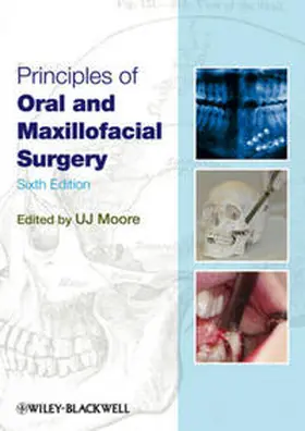 Moore | Principles of Oral and Maxillofacial Surgery | E-Book | www.sack.de