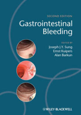 Sung / Kuipers / Barkun | Gastrointestinal Bleeding | E-Book | sack.de