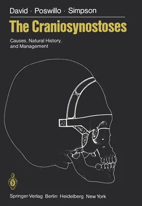 David / Poswillo / Simpson |  The Craniosynostoses | Buch |  Sack Fachmedien