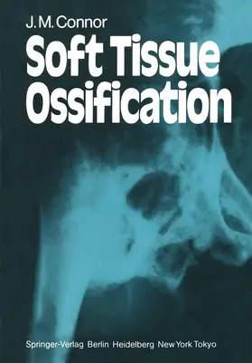 Connor |  Soft Tissue Ossification | Buch |  Sack Fachmedien